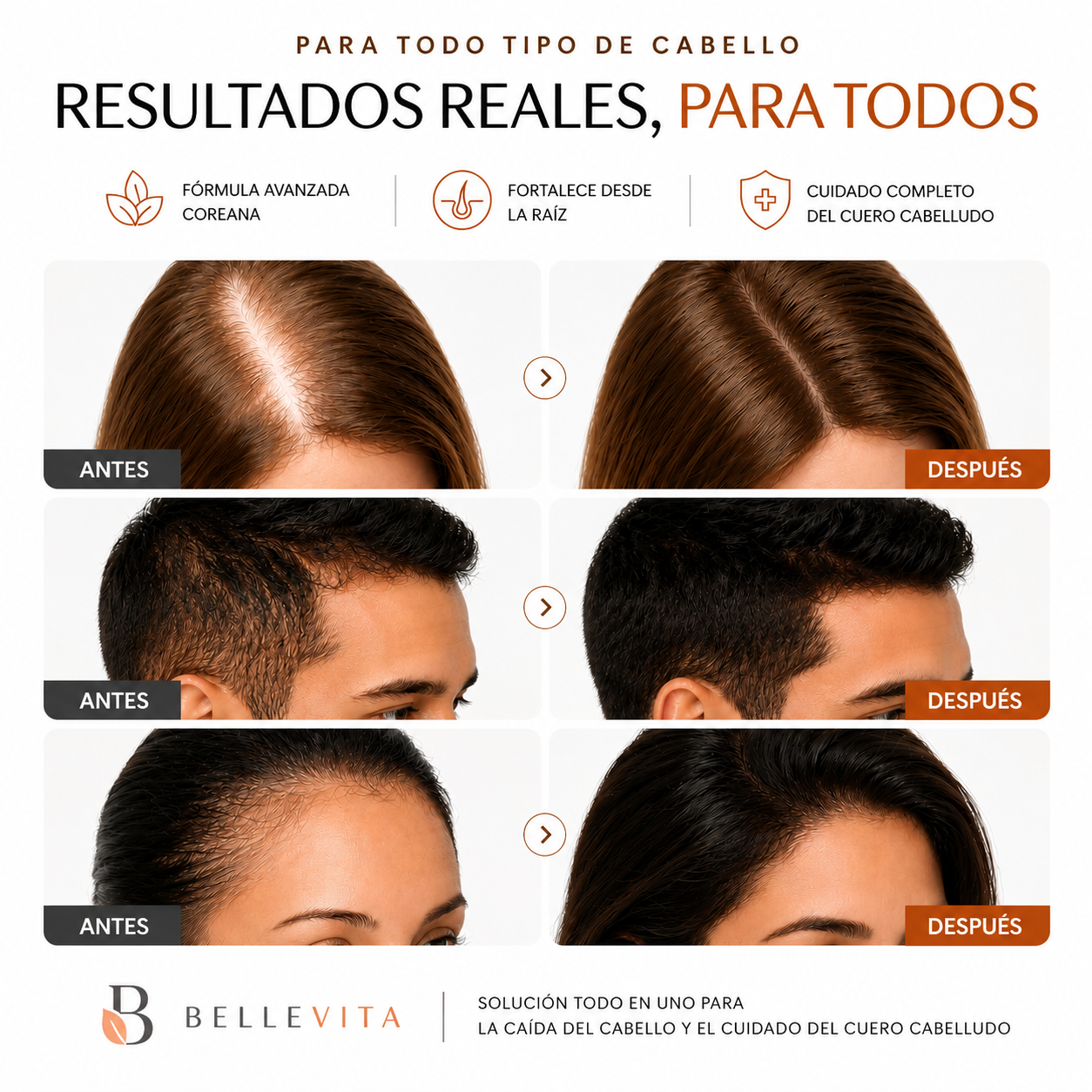 Serum Capilar 100ml | Frena La Caída en Pocas Semanas
